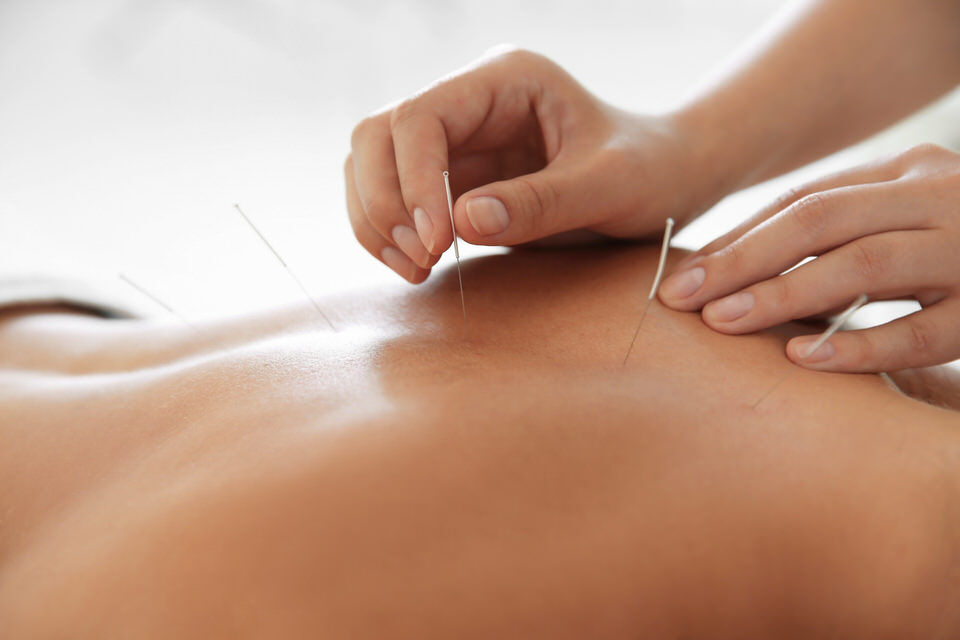 Pukekohe Acupuncture